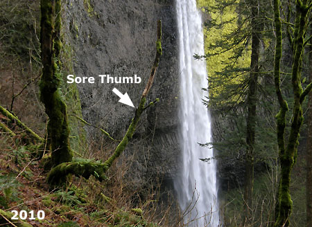 …and the sore thumb that once was…